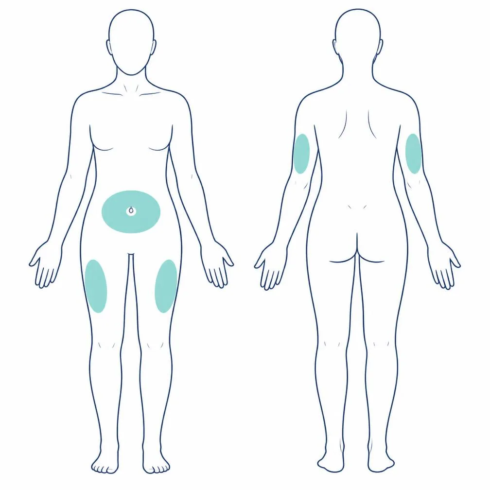 Body diagram highlighting common subcutaneous injection areas: abdomen, outer thighs and back of the upper arms